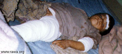 Wounded child in Jalalabad