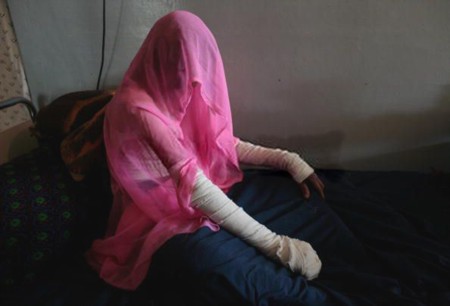 Self-Burning Among Afghan Women