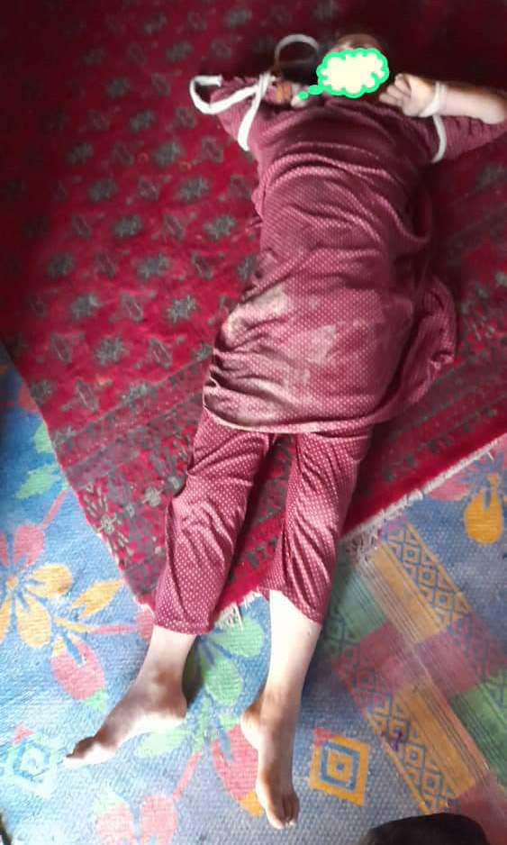 The body of a 16-year-old girl from Shirin Tagab district